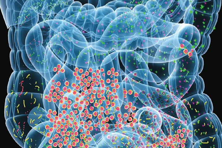 Влияние микробиома на эффективность иммунотерапии. Просто знание или возможность влиять на исход?