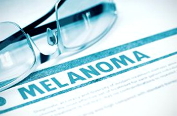 Риск злокачественных новообразований в семьях с меланомой: новые данные в отношении наследственности