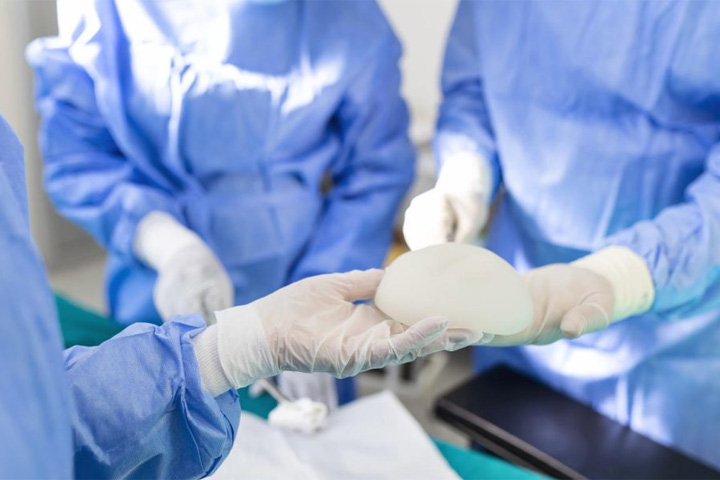 Лучевая терапия после реконструкции при раке молочной железы: экспандер или имплантат?
